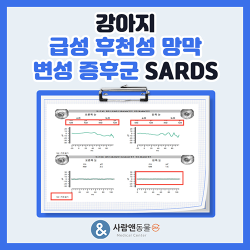 [SARDS] 눈 상처나 충혈도 없는데 갑자기 앞을 보지 못한다면? 급성 후천성 망막 변성 증후군 SARDS 진단 사례
